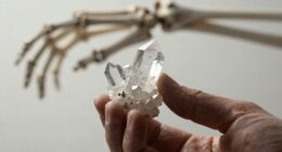 additional factors for bones