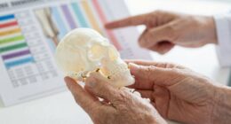 questions about bone health