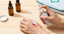This spray-on powder can stop life-threatening bleeding in 1 second